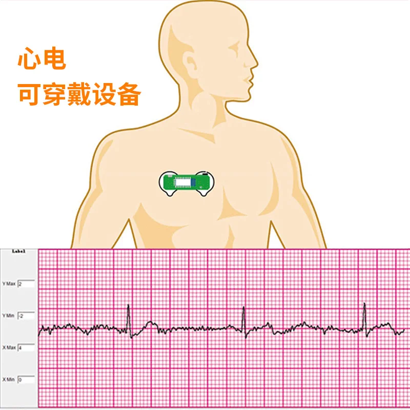 BMD101 ECG Electrocardiogram S - đánh giá và giá Ecg Patch Monitor